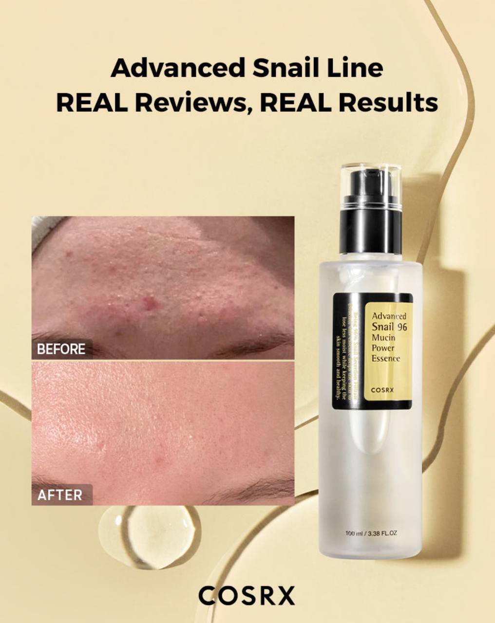 اسنس حلزون کوزارکس